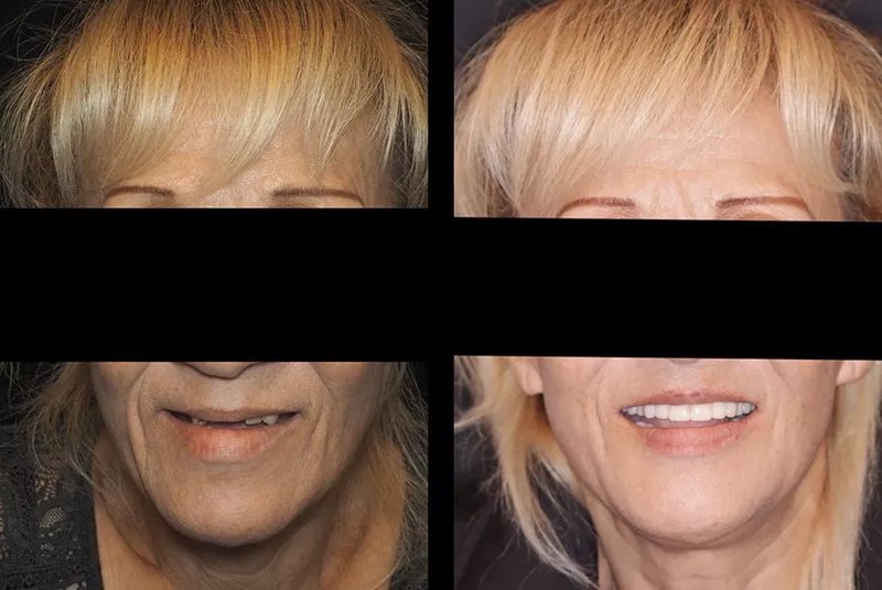 Before After Image