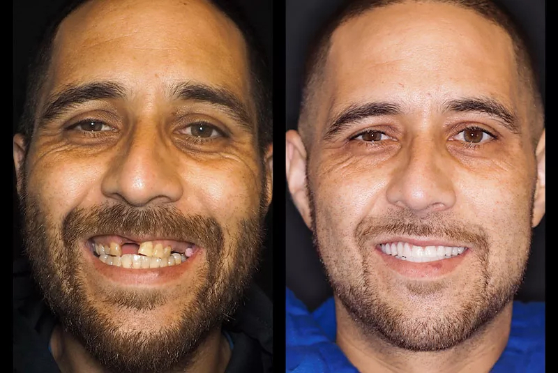 Before After Image