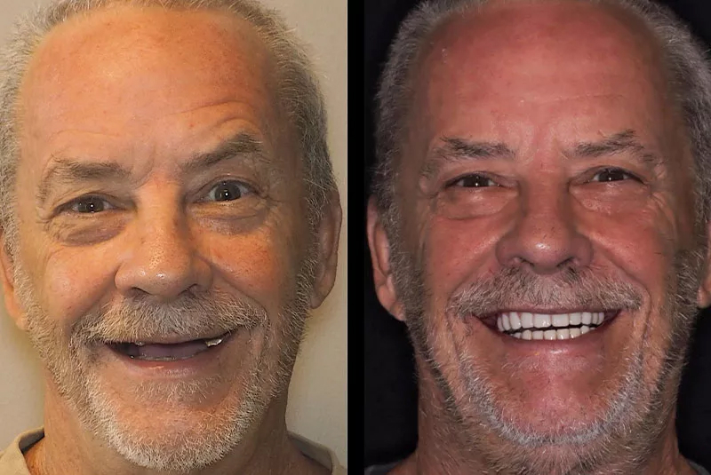 Before After Image