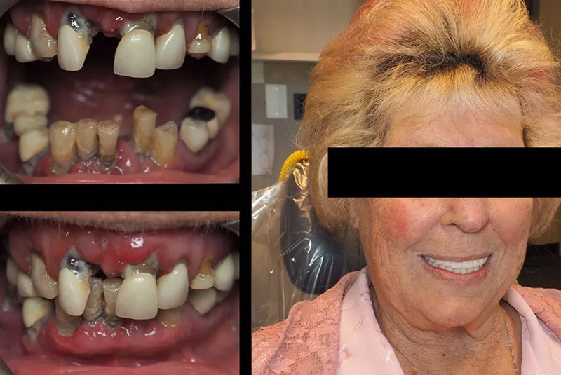Before After Image