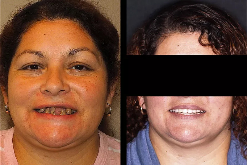 Before After Image